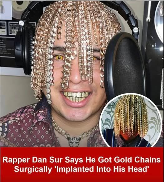 Rapper had surgery to get gold chains implanted into his skull