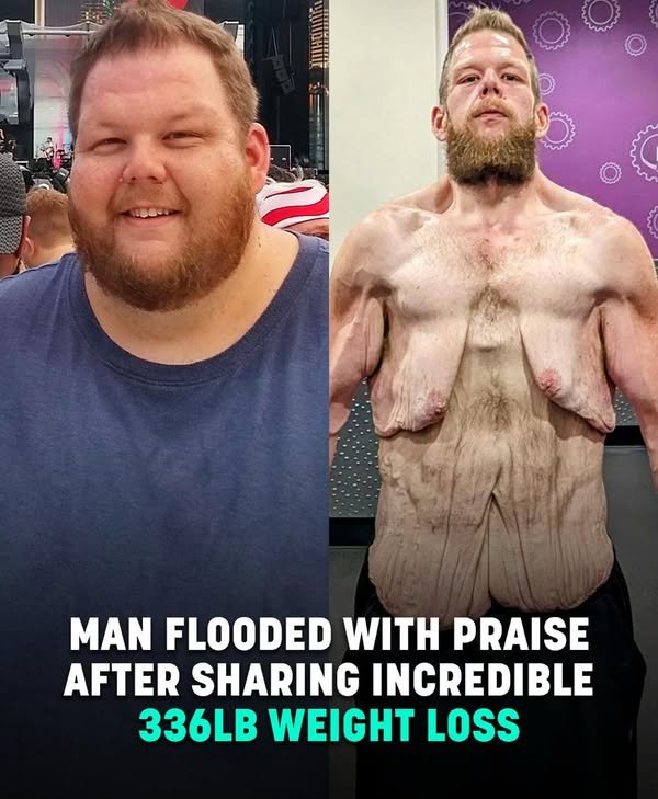 Man Receives Overwhelming Praise for Incredible 336lb Weight Loss Transformation