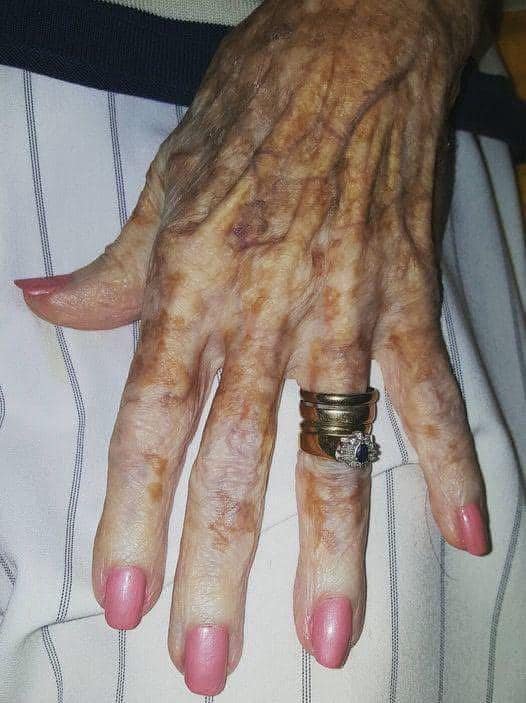 Nursing home worker reveals real truth about beauty