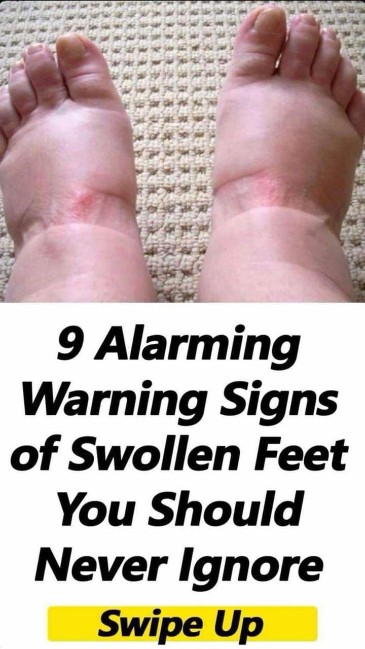 There are nine scary warning symptoms of swollen feet that you should never overlook