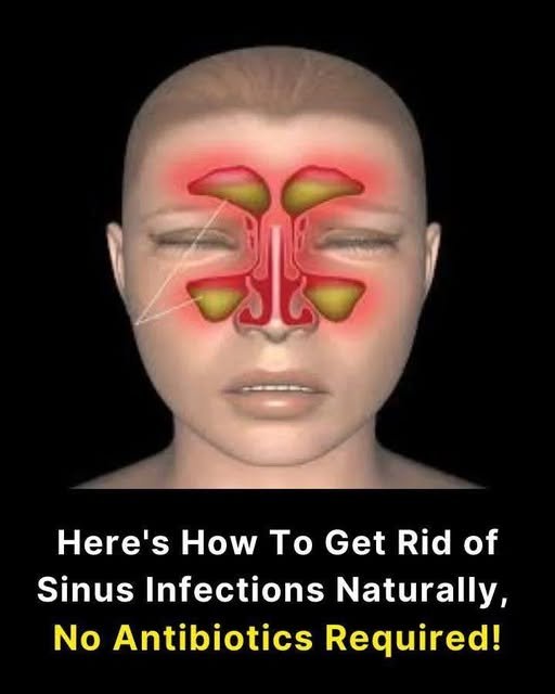 10 Natural Remedies To Help Deal With a Sinus Infection