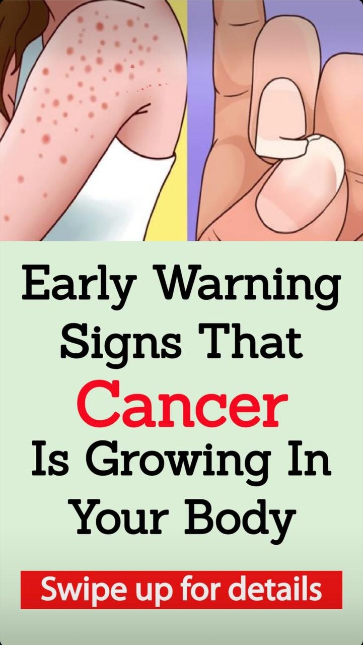 You Should Pay Attention to These 15 Early Warning Signs of Cancer in Your Body